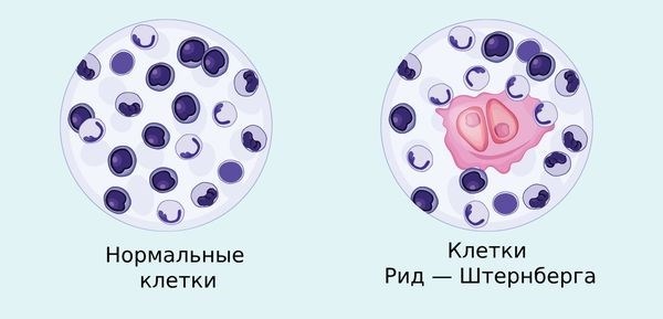 Инструментальная диагностика